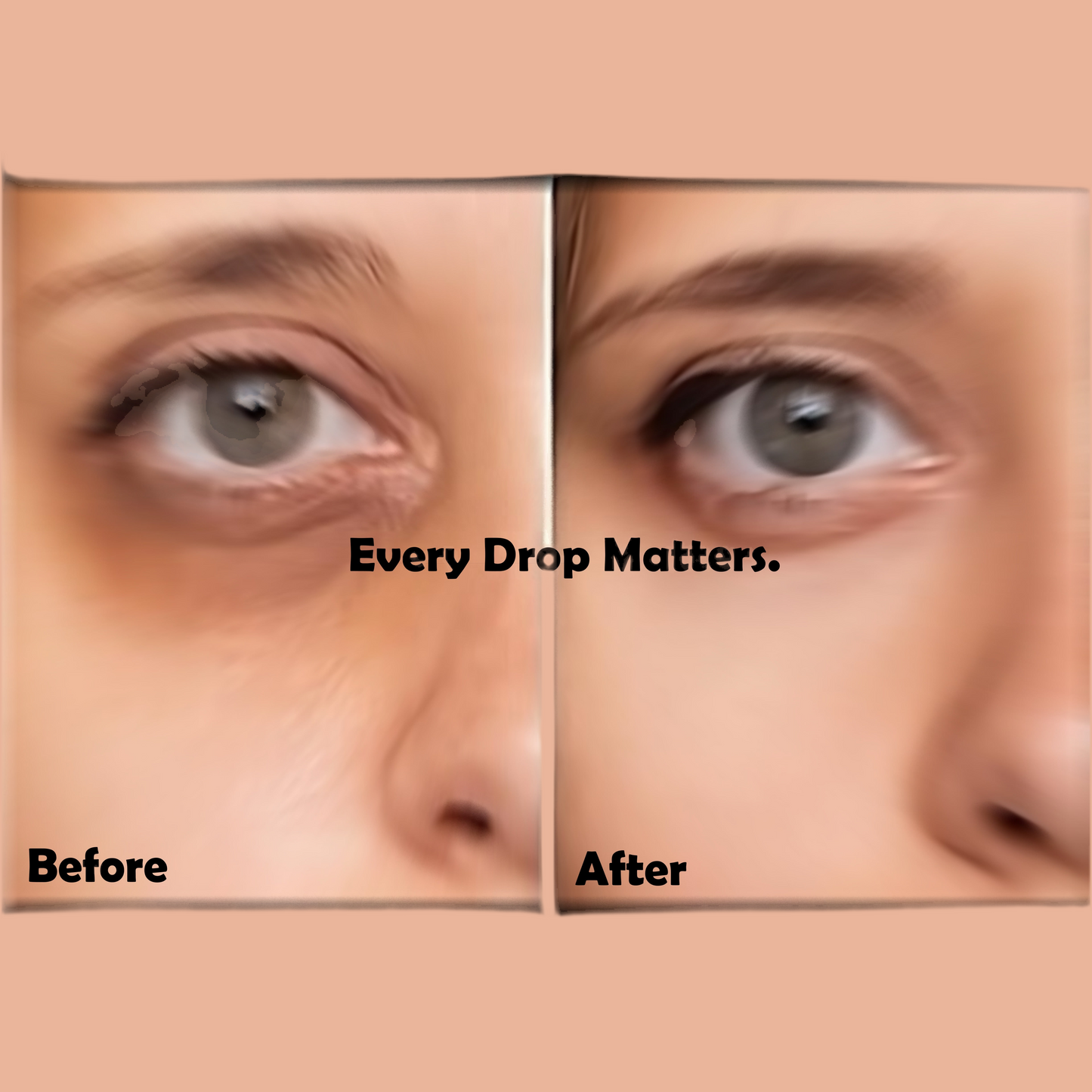 Eye Roller | Eliminates Dark Circles & Puffy Eyes