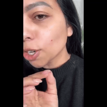 Electronic Acne Patch | Eliminates Pimple and Acne-6 pcs